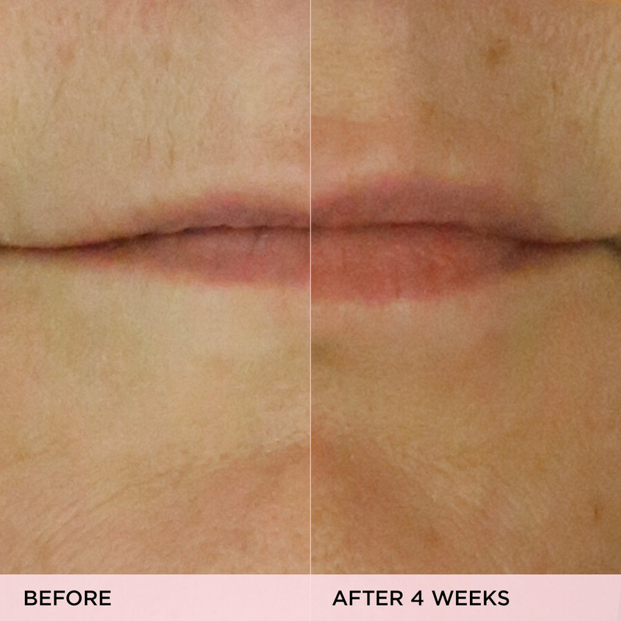 siero labbra volumizzante kissu lip treatment